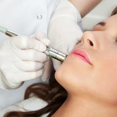 newapeel-microdermabrasion-facial